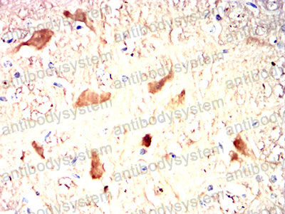 Валидация AntibodySystem RHC44503 (1041)