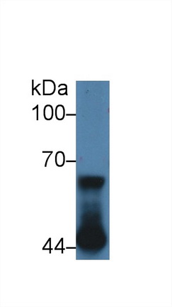 14287