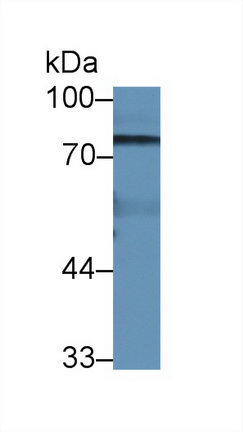 14186