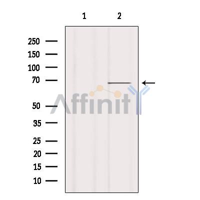 Валидация Affinity AF6172 - 3393