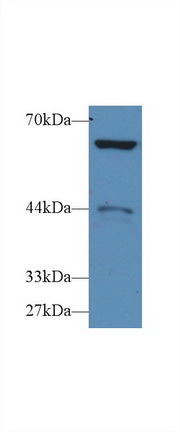 14556