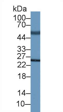 62758