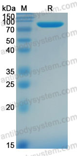 AHD65602, SDS-PAGE