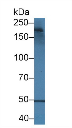 14369