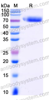EHJ20602, SDS-PAGE