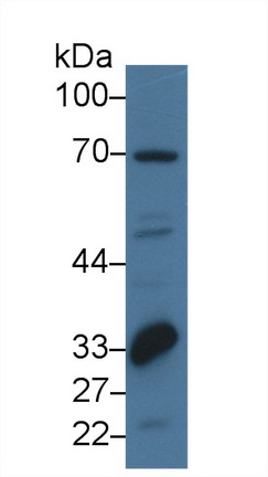 14773