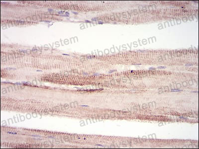 Валидация AntibodySystem RHK37402