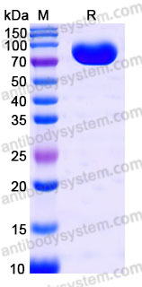 AHD80901, SDS-PAGE