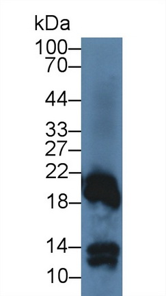 27285
