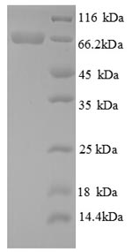 SDS-PAGE