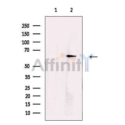 Валидация Affinity DF13660 - 9223