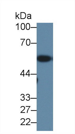 13556