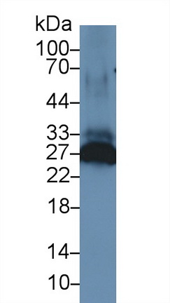 13300