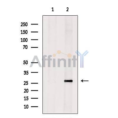 Валидация Affinity DF13306 - 8452