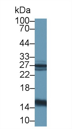 14537