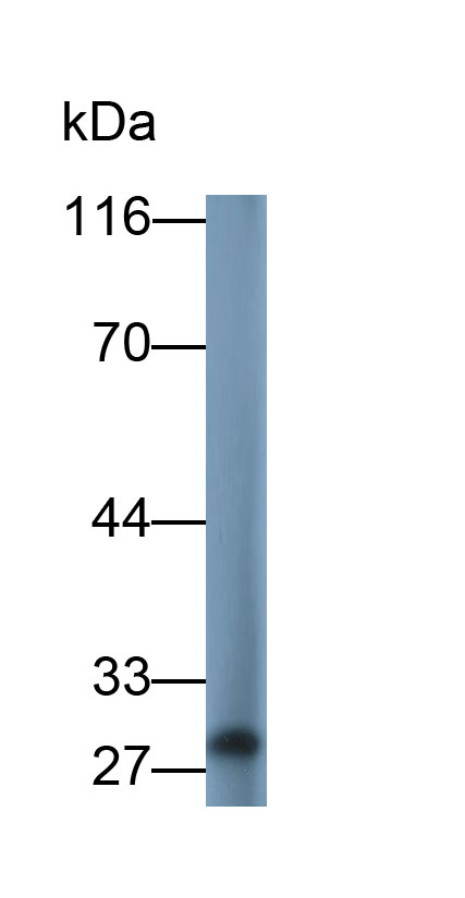 31011