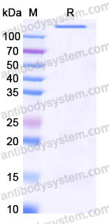EHB86905, SDS-PAGE