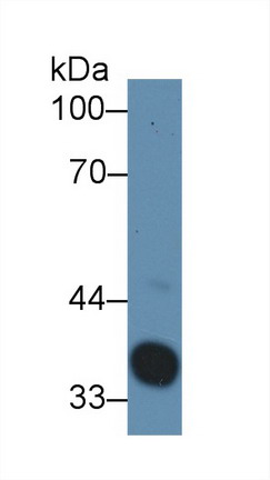 8526