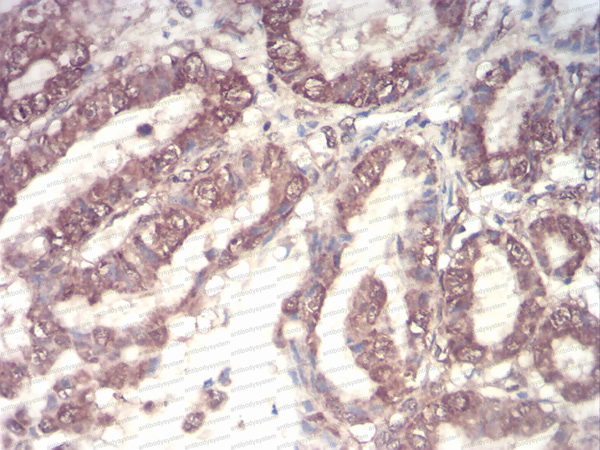 Валидация AntibodySystem RHC44302