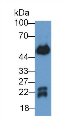 62139