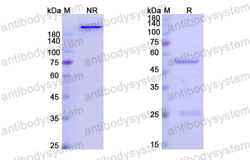 Валидация SDS-PAGE - AntibodySystem DHJ94701