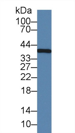 14832