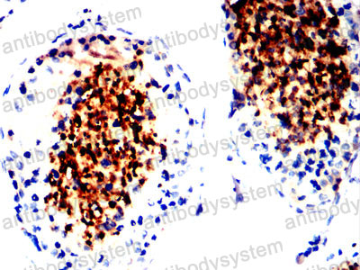 Валидация AntibodySystem RHH44601