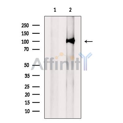 Валидация Affinity DF6930 - 18535