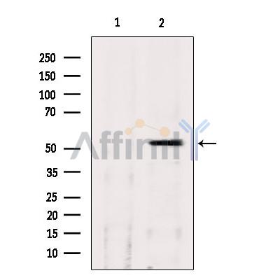 Валидация Affinity DF6421 - 17792