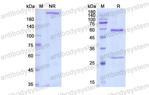 Валидация SDS-PAGE - AntibodySystem DHH72404