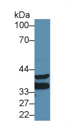 14147