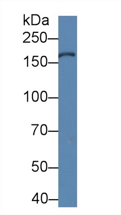 12692