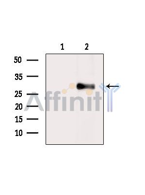 Валидация Affinity DF14084 - 9871