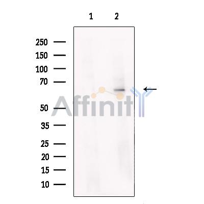 Валидация Affinity DF13557 - 9000