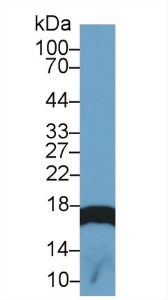 17582