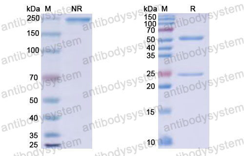 Валидация SDS-PAGE - AntibodySystem RHJ92822