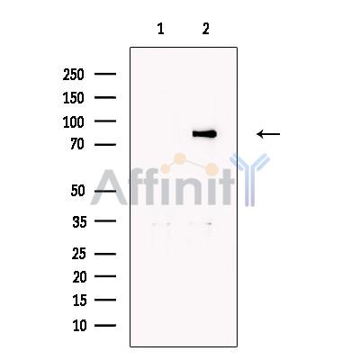 Валидация Affinity DF13292 - 8420