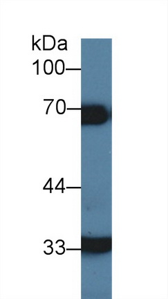 14361