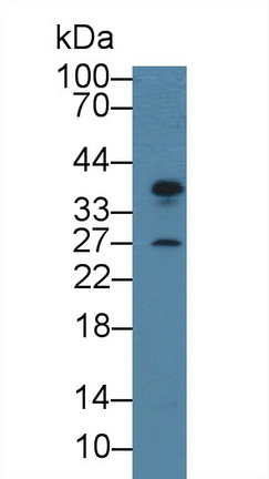 14236