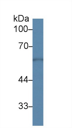 14533