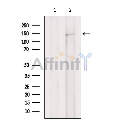 Валидация Affinity DF9891 - 22845