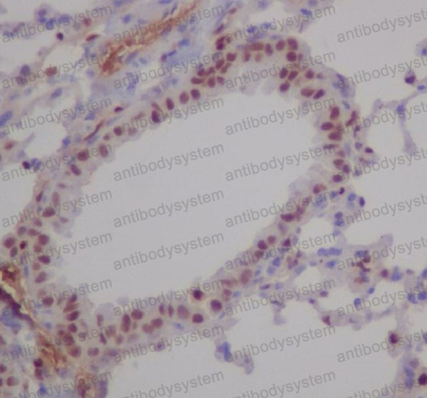 Валидация AntibodySystem RHF86101