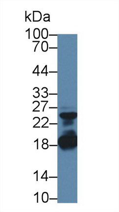12803