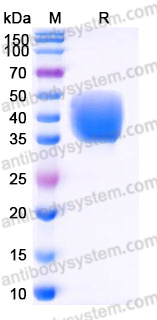 EHJ77502, SDS-PAGE