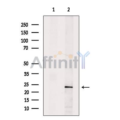 Валидация Affinity DF9534 - 22185