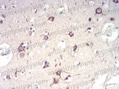 Валидация AntibodySystem RHD69005