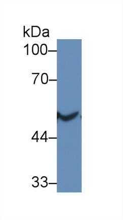 14913