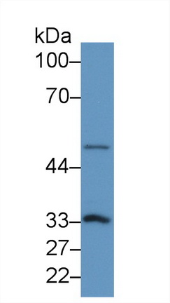 14774