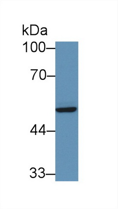 12956