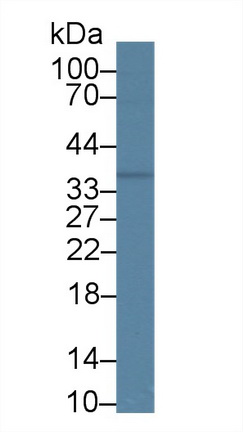 14393